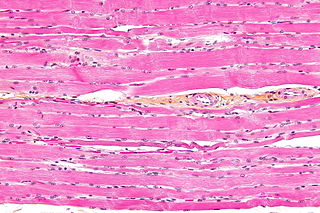 <span class="mw-page-title-main">Striated muscle tissue</span> Muscle tissue with repeating functional units called sarcomeres