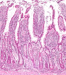 Small intestine low mag.jpg