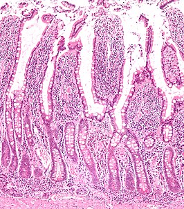 Microscopische vergroting die de darmvlokken in het darmslijmvlies laat zien.