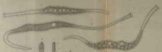 <span class="mw-page-title-main">Trachelocercidae</span> Family of single-celled organisms