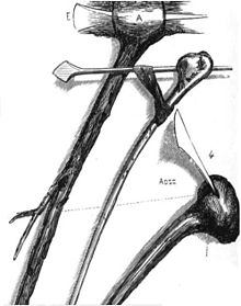 Primitive tools based on 19th century knowledge.