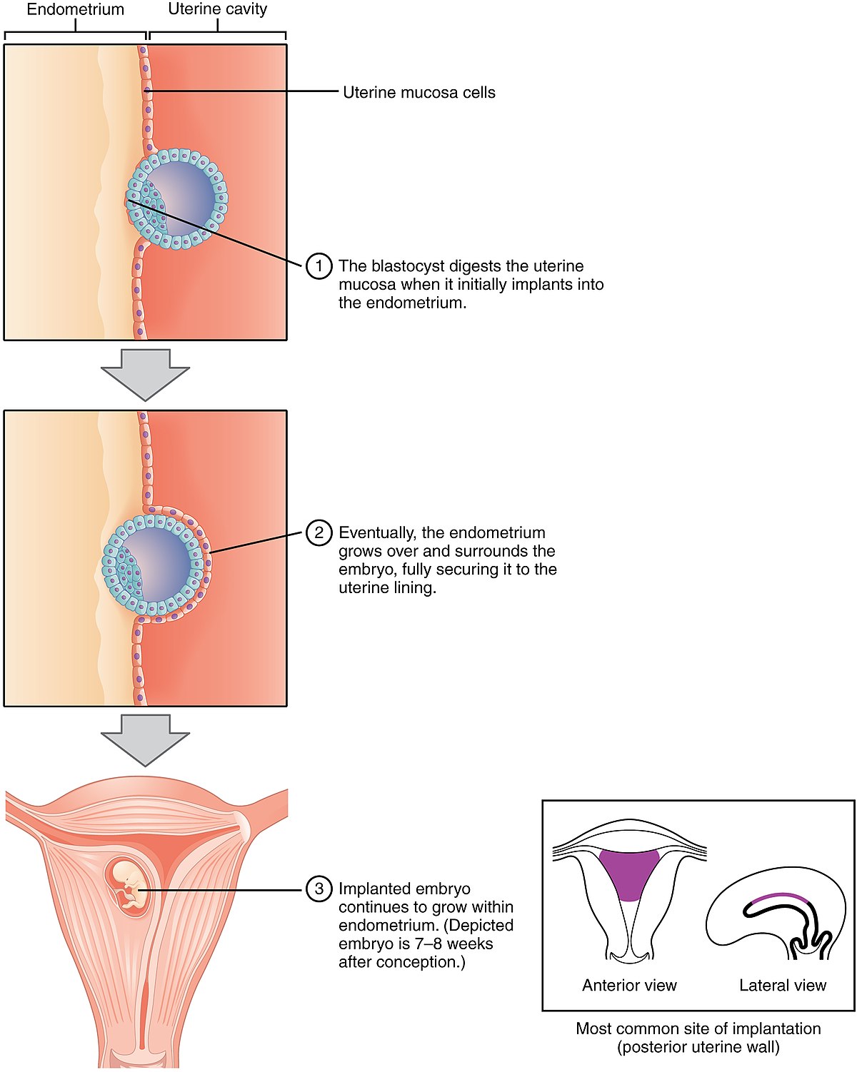 File:Diferencial rearmable.jpg - Wikimedia Commons