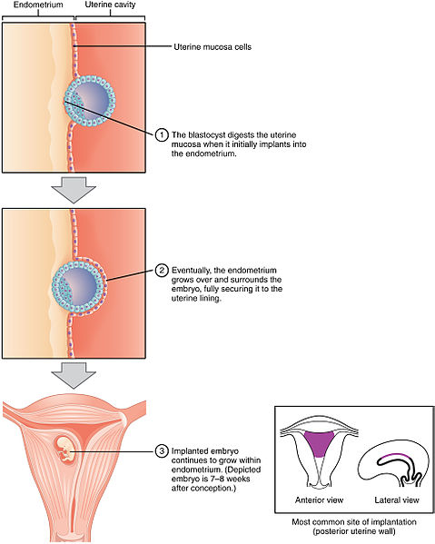 File:2905 Implantation.jpg