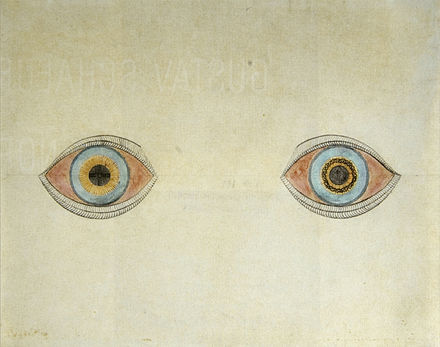 My Eyes at the Moment of the Apparitions by German artist August Natterer, who had schizophrenia