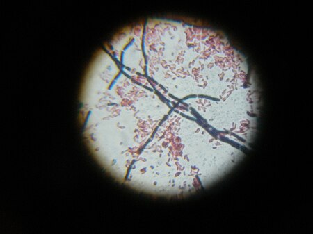 Tập_tin:Bacillus_cereus_and_Escherichia_coli.jpg