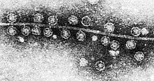 Bacteriophage Qβ attached to sex pilus of E. coli.jpg