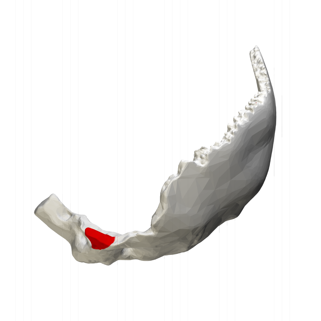 File:Jugular process of occipital bone - close-up07.png - Wikimedia Commons