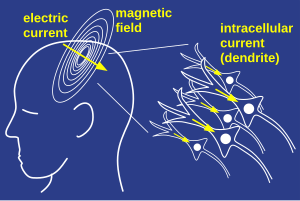 Mind Uploading