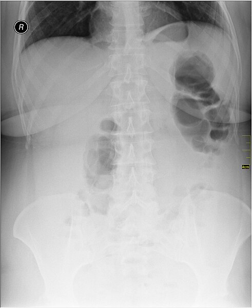 File:Medical X-Ray imaging QUL06 nevit.jpg