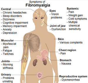 Common signs and symptoms of fibromyalgia. (Se...