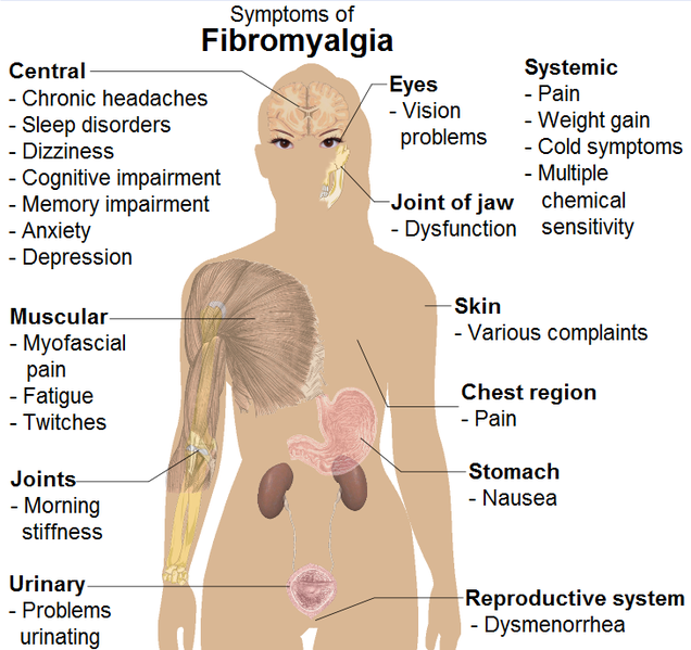 File:Symptoms of fibromyalgia.png