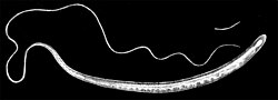 Trichuris trichiura1.jpg