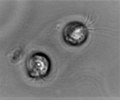 File:2 Calcidiscus leptoporus, haploid, two cells in one membrane, LM.tif