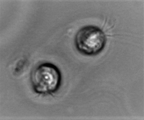 File:2 Calcidiscus leptoporus, haploid, two cells in one membrane, LM.tif