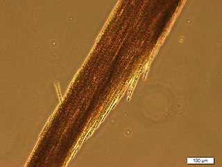 <i>Aphanizomenon flos-aquae</i> Species of bacterium