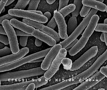 Scanning electron micrograph of Escherichia coli bacilli
