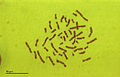 Human karyotype (259 34) Karyotype Human 46,XX (woman).jpg
