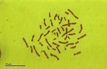 Human karyotype (259 34) Karyotype Human 46,XX (woman).jpg