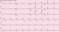 Pisipilt versioonist seisuga 7. juuni 2012, kell 02:18