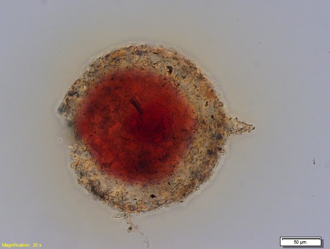 File:Collection Penard MHNG Specimen 274-4-5 Difflugia lithoplites.tif