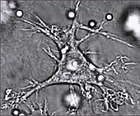 Dendritic cell.JPG