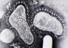 Electron micrograph of two coronaviruses.jpg