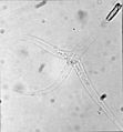Myxozoa
