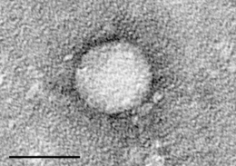 Elektronmikroszkópos felvétel a HCV vírusról (negatív festés). Skálavonal = 50 nanométer