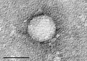 Snímek z elektronového mikroskopu, virus hepatitidy C izolovaný z buněčné kultury (měřítko = 50 nm)