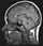 MRI brain.jpg