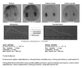 Miniatura pro Dynamická funkční scintigrafie ledvin