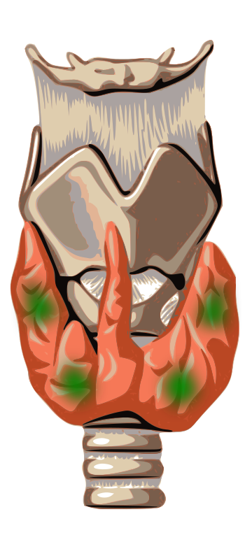 Parathyroid carcinoma