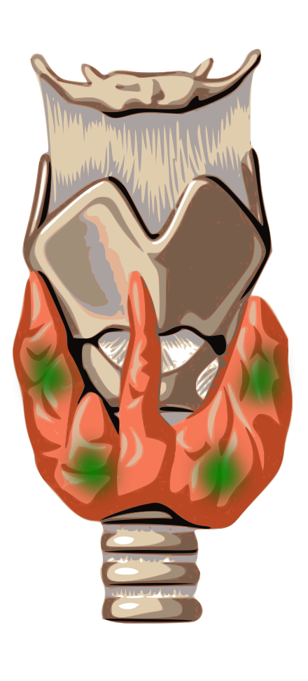 Parathyroid gland anatomy (green marks)