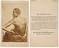 Thumbnail for File:Scourged Back cdv by McAllister &amp; Brothers, c1863.jpg