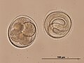 Toxocara canis eggs - embryonated and with larva