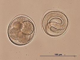 Toxocara eggs- the surface contour is pitted due to the mammilation of the protein layer of the shell, and because of this the eggs are murky Toxocara embryonated eggs.jpg