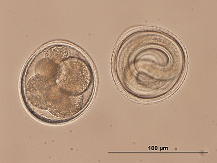 Œufs microlécithaux de nématode (Toxocara ici)