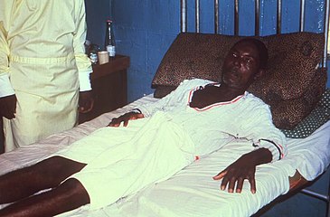 Male with Lassa fever in 1977 lying in a hospital bed in Segbwema, Sierra Leone. Note his dazed, somnolent facial expression due to his weakness, and exhaustion.