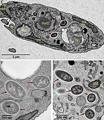 TEM-Aufnahmen von Ca. Bc. vickermanii in B. saltans