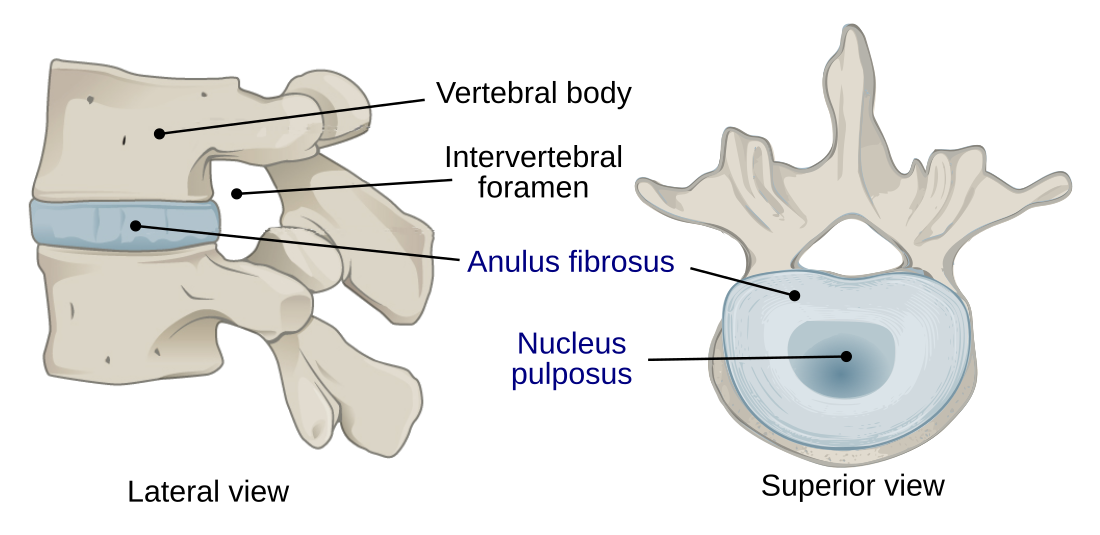 Intervertebral disc