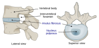 Thumbnail for Intervertebral disc