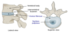 716 Intervertebral Disk