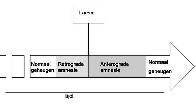 Description de l'image Amnesie.jpg.