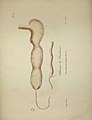 Planche anatomique, intitulée « Oblitération du Duodénum », représentant un morceau d’intestin coupé en deux.