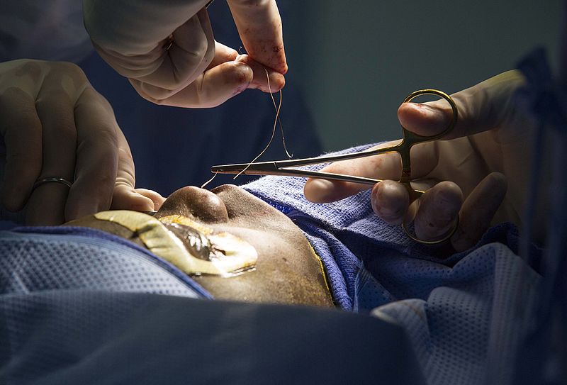 File:Bougainville boy receives corrective surgery aboard USNS Mercy 150702-M-DN141-263.jpg