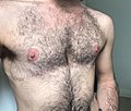 Thumbnail for Chest reconstruction