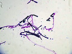 Description de l'image Geotrichum candidum 01.jpg.