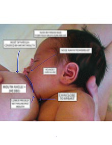 Educational posters on Kangaroo Mother Care, Proper Latching, and  Breastmilk Expression and Storage