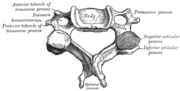 Thumbnail for Intertransverse ligament