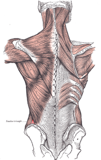 Petits hernia Medical condition